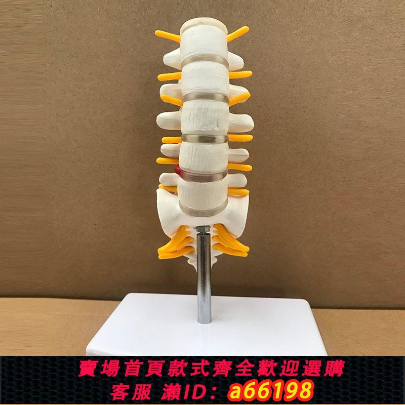 【臺灣公司 可開發票】小腰椎脊柱模型人體骨骼模型頸椎骨神經腰椎間盤醫用教學模型