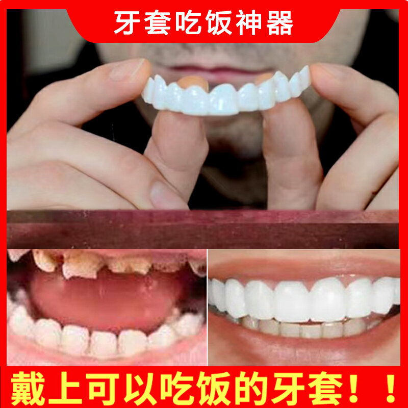 日本進口MUJIE慕潔老人男女通用牙套吃飯神器 塞牙缺牙美白假牙套